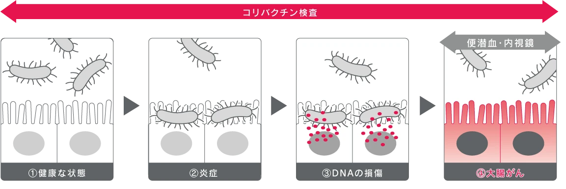 健康な状態から大腸がんまでのプロセスと検査範囲の比較図